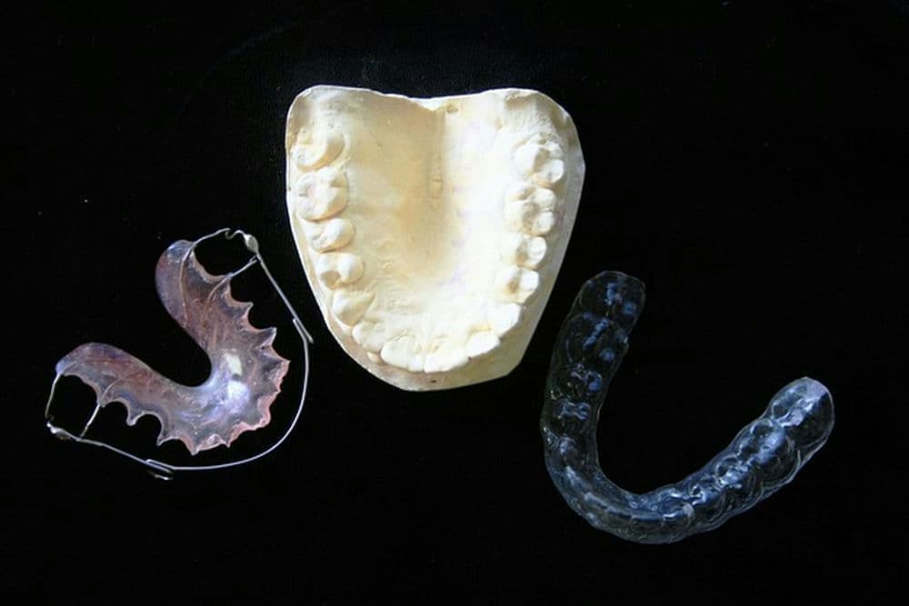 partial dental implants