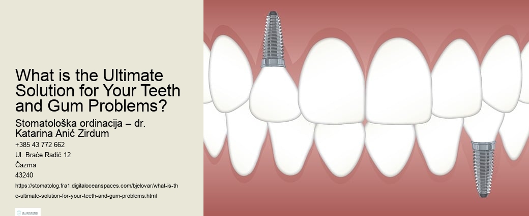 Dental Implants Cost In Rands dental-implants-cost-in-rands